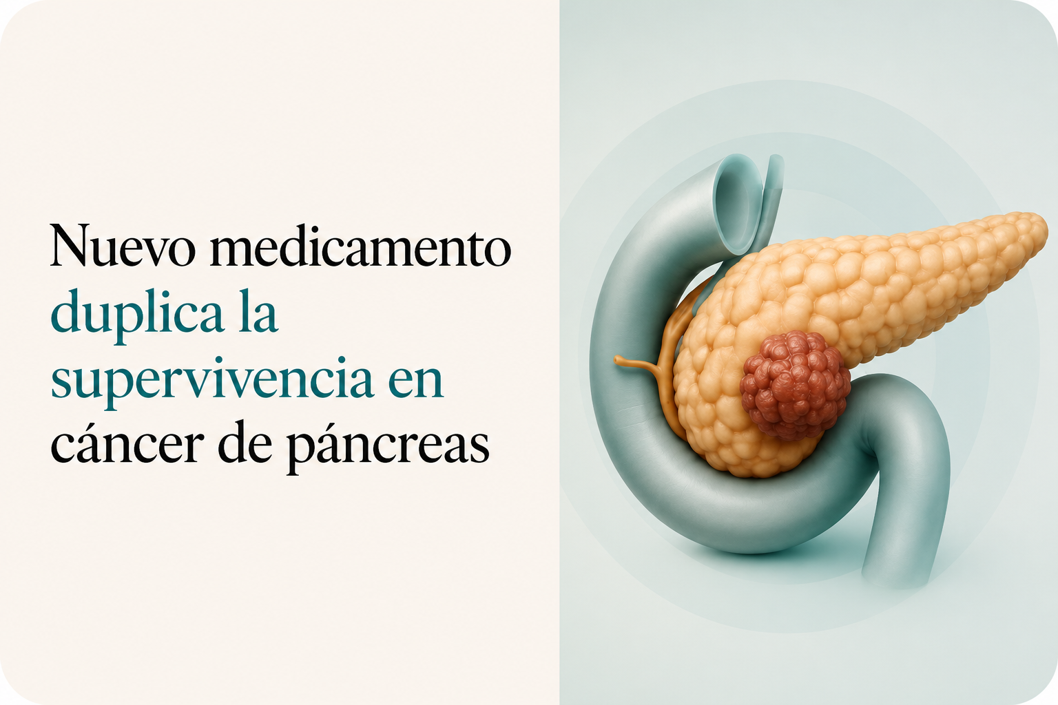 Nuevo medicamento duplica la supervivencia en cáncer de páncreas: el avance que emocionó a la comunidad médica